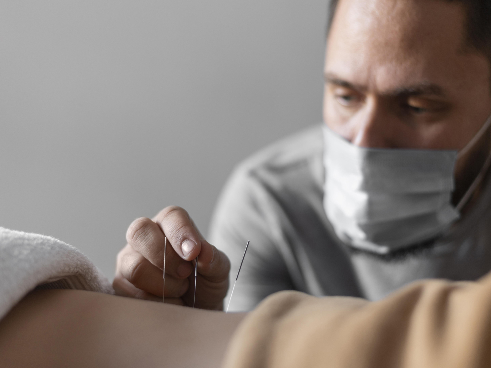 How Dry Needling Can End Your Pain? 