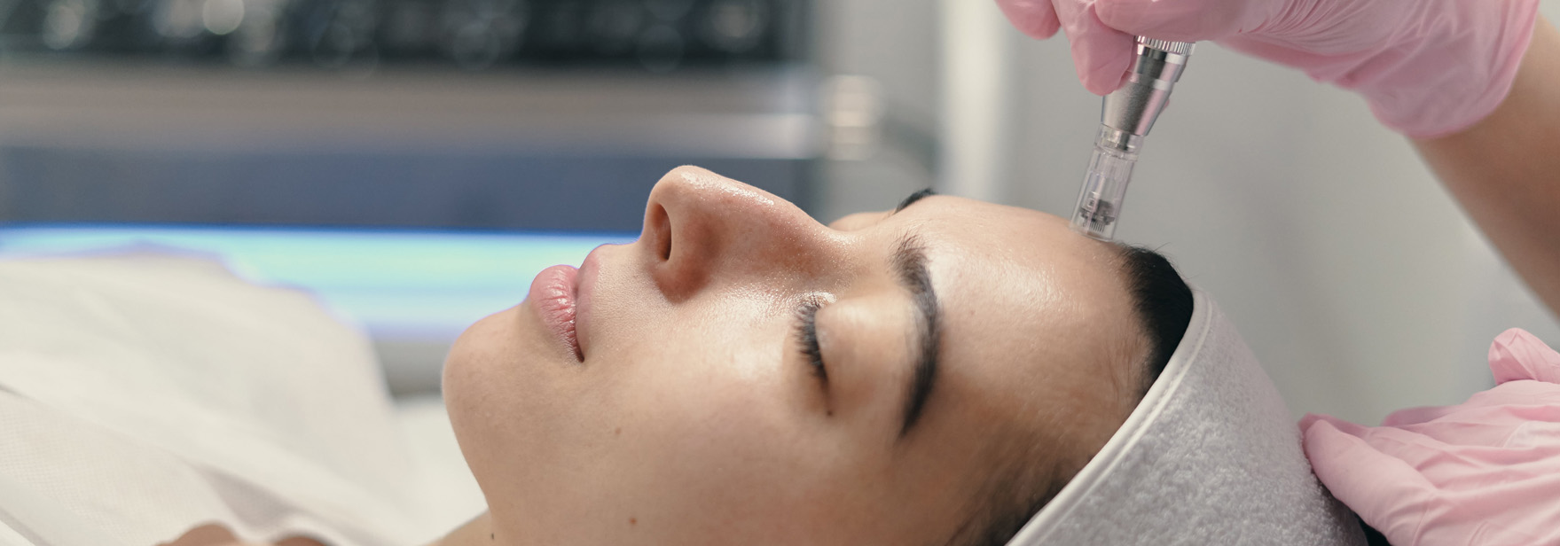 RF Microneedling Treatment for the Skin (Aesthetic)
